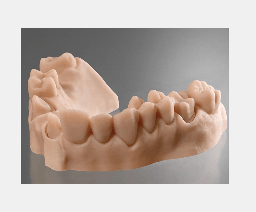 Economic Restoration Demonstration Dental Mold018